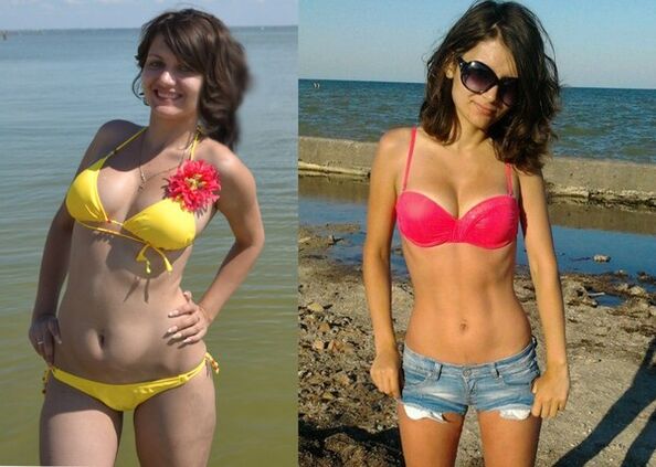 Anna zaudēja 10 kg ar NexaSlim